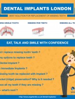 Dental Implants London [INFOGRAPHIC]