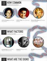 Journey Through a Vein – Varicose Vein Treatment [INFOGRAPHIC]